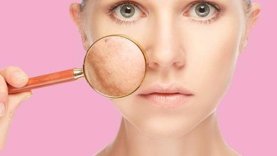 Pigmentation Removal Clinic